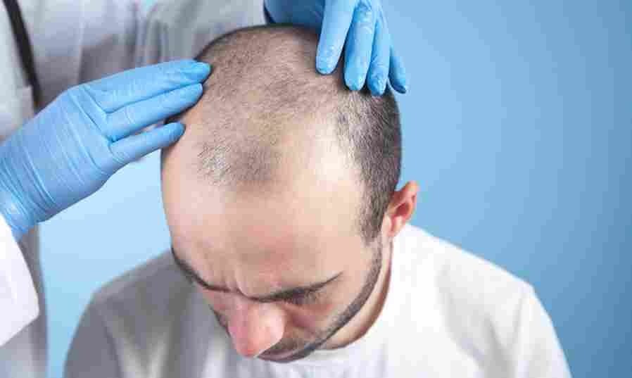 Hair Transplant Istanbul: Leading Clinics for Natural Results