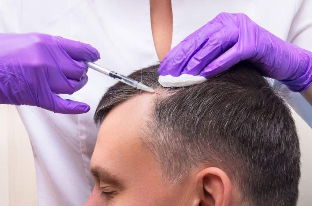 Hair Transplant Istanbul – Professional Care You Can Trust